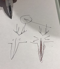 �y����z�h�N�^�[����N���j�b�N�͐V�h�Ŕ��Q�̈�ÒE�сB���S�҂ł����C���o����B