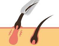 �q�Q����