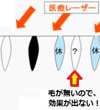 ��ÒE�т̌��ʂ��䖳��