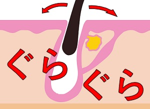 �D�_�E�̖�