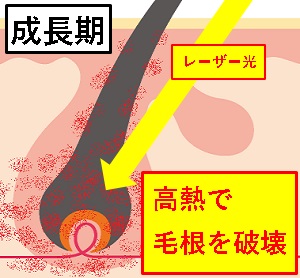 �]���̃��[�U�[�E��