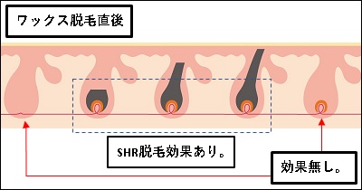 ���b�N�X�E�ь�̖ь���SHR�E�т̌���